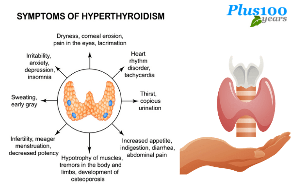 hyperthyroidism symptoms checklist 