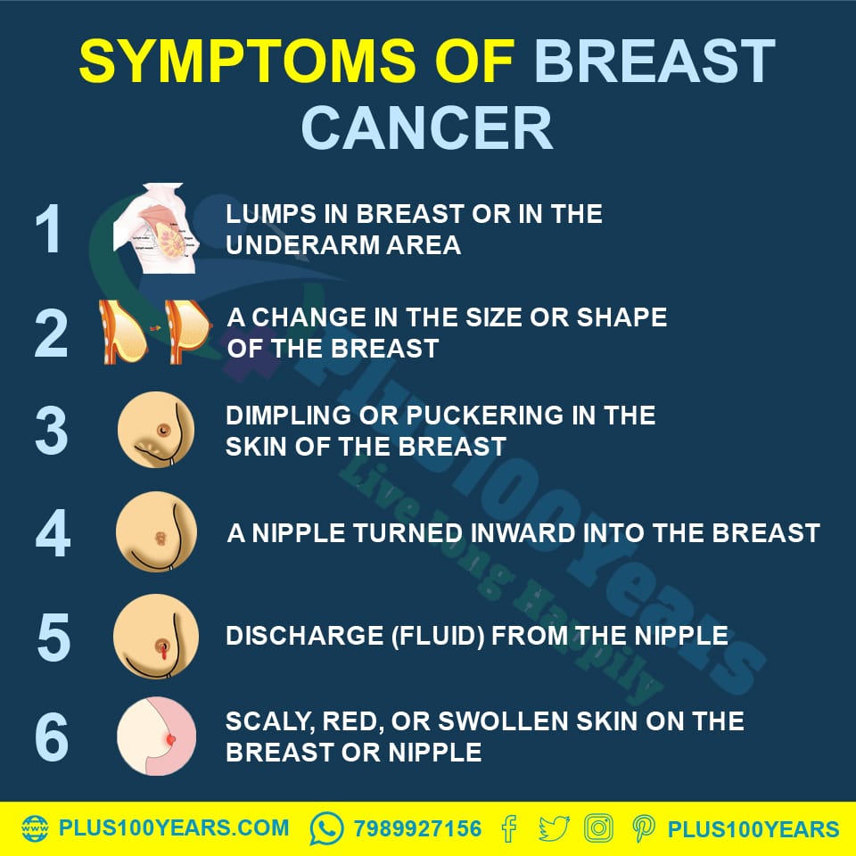 Symptoms of Breast Cancer || Symptoms of Breast Cancer