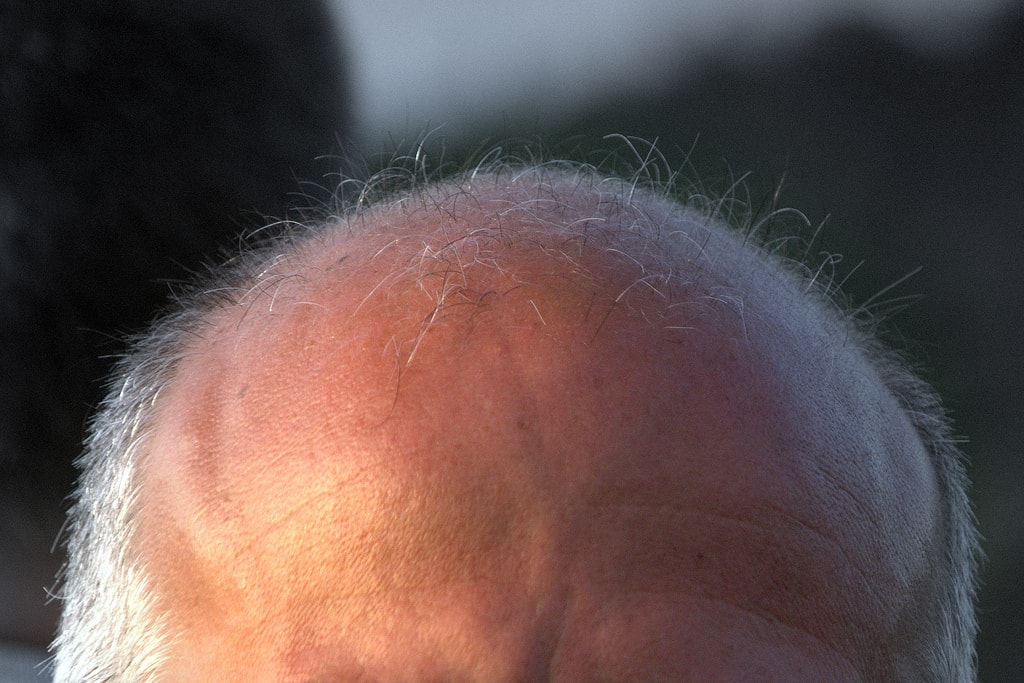 tips for hair growth on Bald Head