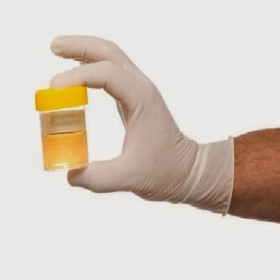 urinalysis || urinalysis test