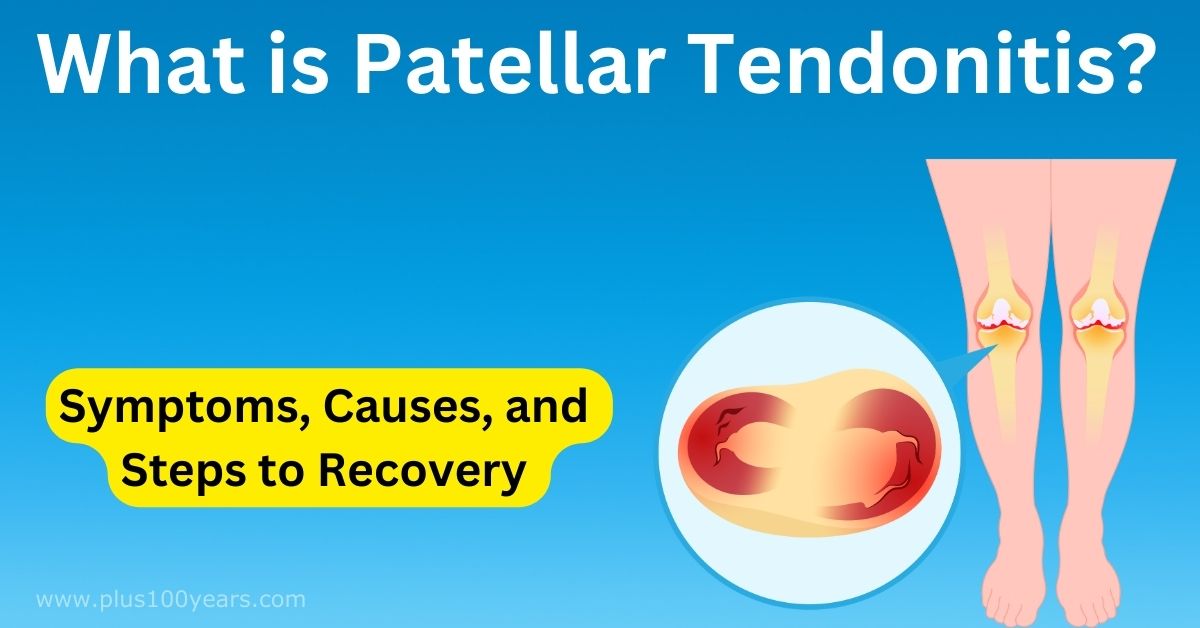 What is Patellar Tendonitis  