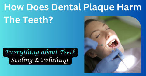 How Does Dental Plaque Harm The Teeth 