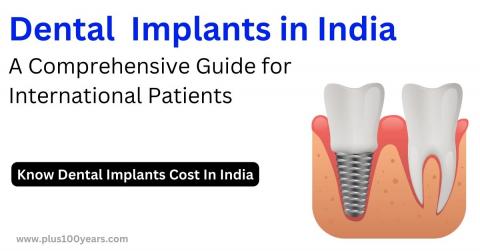 dental implants cost in India