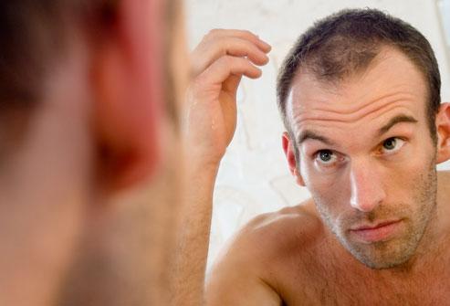 Scalp Acne Treatment Symptoms and Prevention Tips