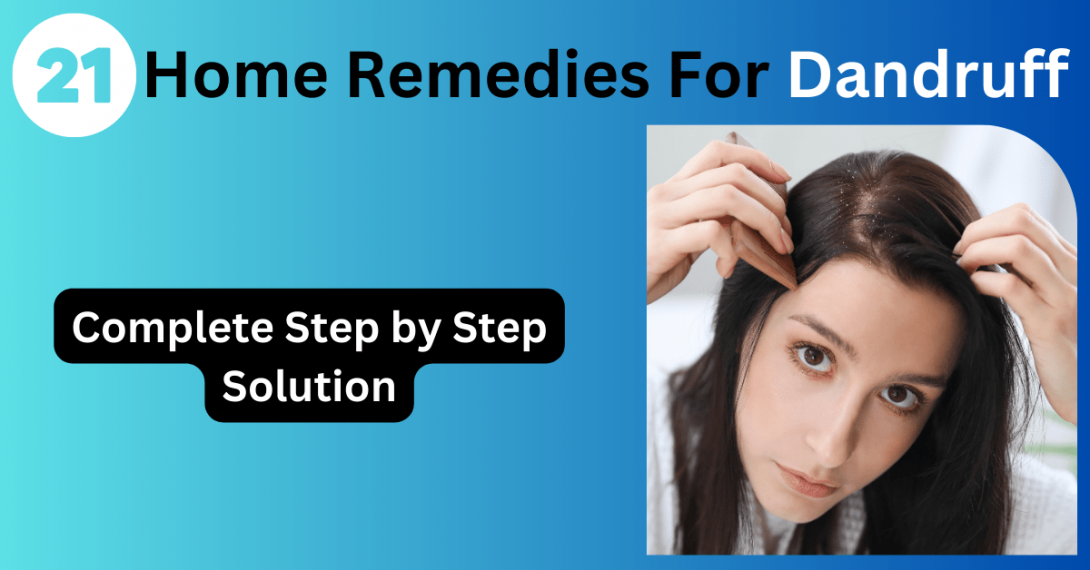 Dandruff Home Remedies  11 Natural Ways to Get Rid of Dandruff  PharmEasy