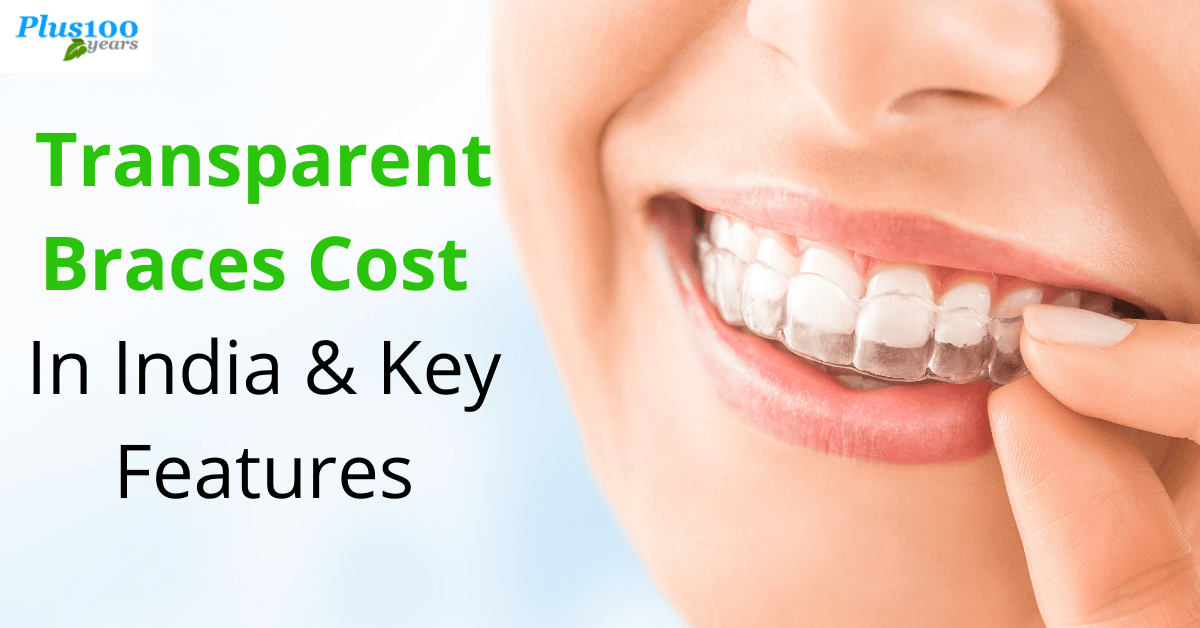 Transparent Braces Cost In India & Key Features