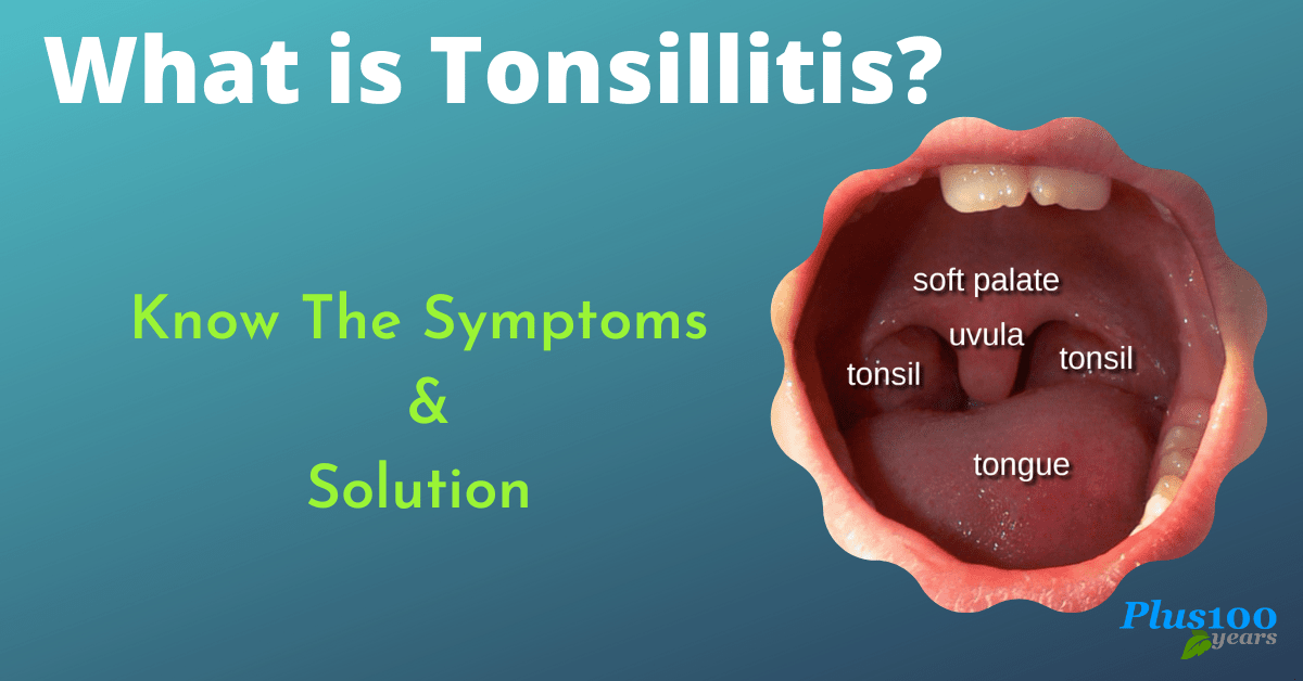 What Is Tonsillitis Know The Symptomsand Solution