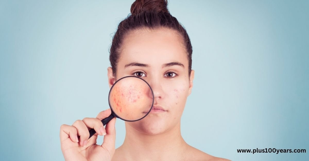 What Causes Pimples or Rashes in Teenagers