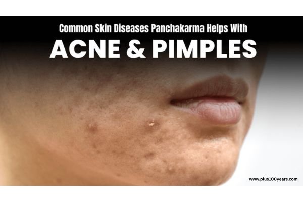 Panchakarma vs. Modern Skin Treatments 2