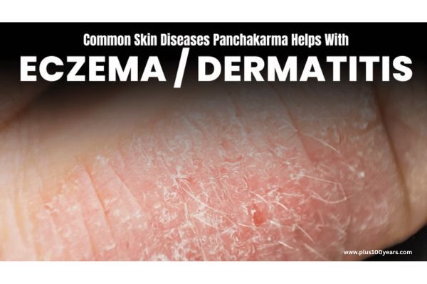 Panchakarma vs. Modern Skin Treatments