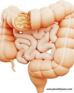 How Your Gut-Brain Axis Shapes Your Mood and Mind