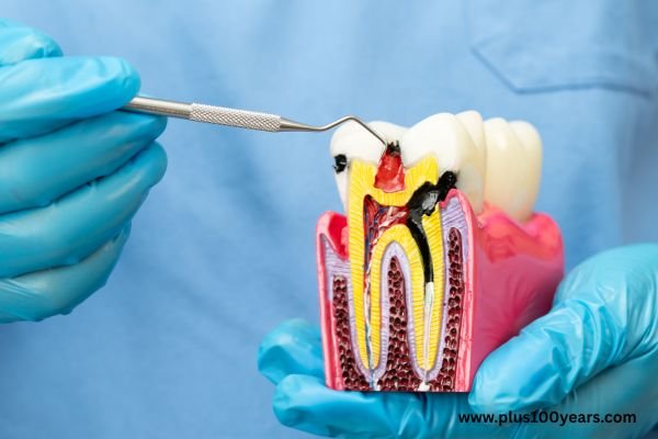 Root Canal Philadelphia Everything You Need to Know Before Treatment