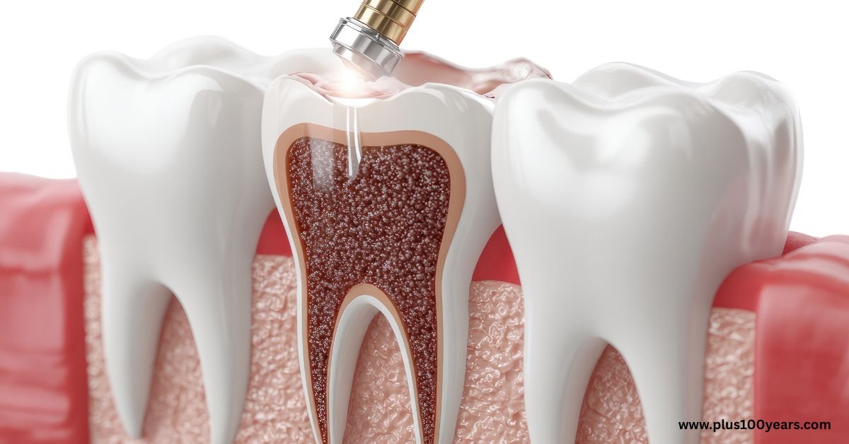Root Canal Philadelphia Everything You Need to Know Before Treatment